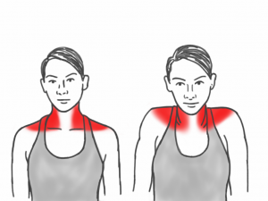 Neck Mobility - Shoulder Shrugs affecting the Trapezius