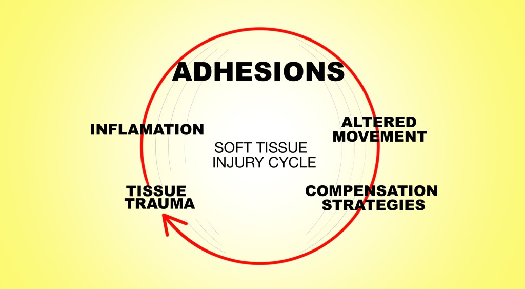 Soft Tissue Injury Cycle