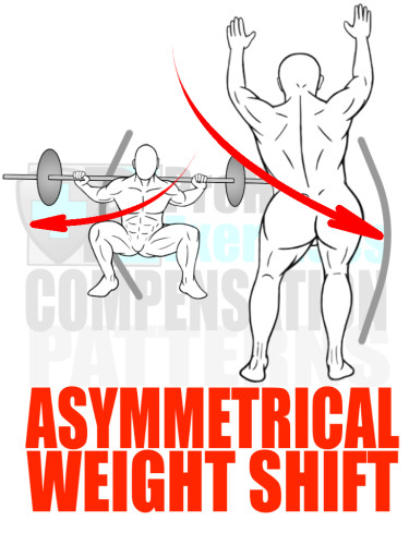 PreHab Exercise eBook - Alignment - Compensation Patterns - Asymmetrical Weight Shift with Direction Lines