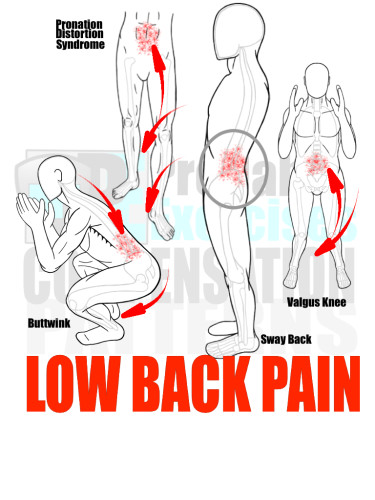 PreHab Exercise eBook - Alignment - Compensation Patterns - Low Back Pain with Direction Lines