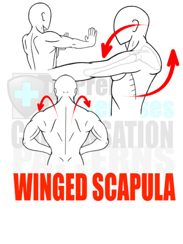 PreHab Exercise eBook - Alignment - Compensation Patterns - Winged Scapula with Direction Lines