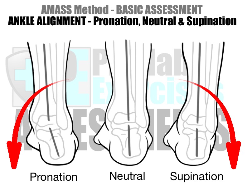 Ankle Strengthening for Over Pronators