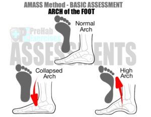 Basic Assessments and Movement Evaluations for Runners - Prehab Exercises